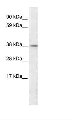 Polyclonal Rabbit anti-Human PSMD11 Antibody (aa276-325, IHC, WB)