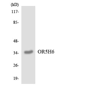 OR5H6 Antibody (aa189-238)