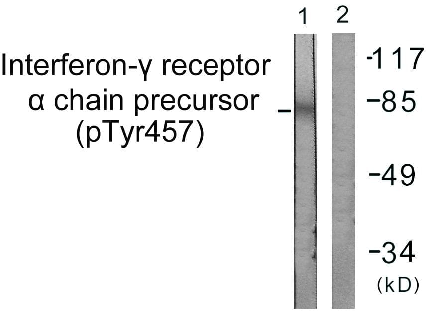 CD119 / IFNGR1 Antibody (phospho-Tyr457)