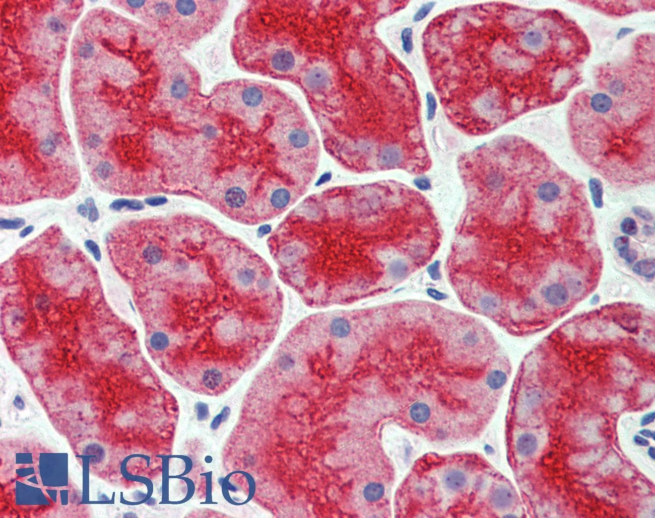 IHC-plus™ Polyclonal Rabbit anti-Human CDHR5 / MUCDHL Antibody (Internal)
