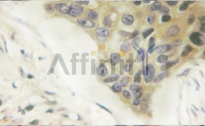 Polyclonal Rabbit anti-Human Vimentin Antibody (phospho-Ser56, IHC, IF, WB)