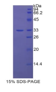Human SLC17A5 Protein (Recombinant His-T7)