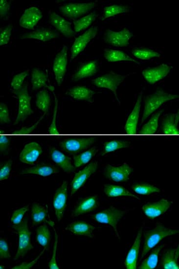 PathPlus™ B2M / Beta 2 Microglobulin Antibody