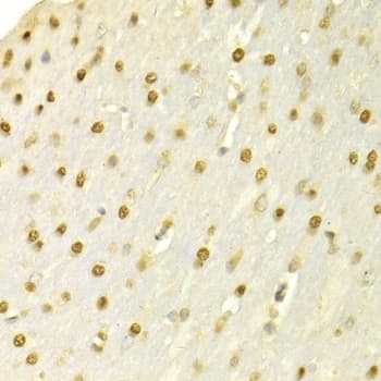 SFN / Stratifin / 14-3-3 Sigma Antibody