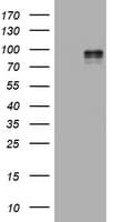 HIF2A / EPAS1 Antibody (aa584-870, clone OTI2G5)