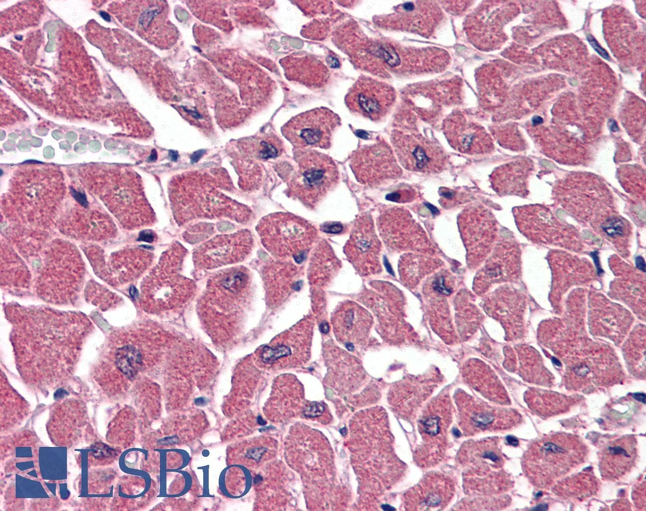 IHC-plus™ Polyclonal Goat anti-Human BPOZ / ABTB1 Antibody (aa465-478, IHC, WB)