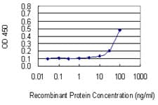 RPL17 / Ribosomal Protein L17 Antibody (clone 3G11)