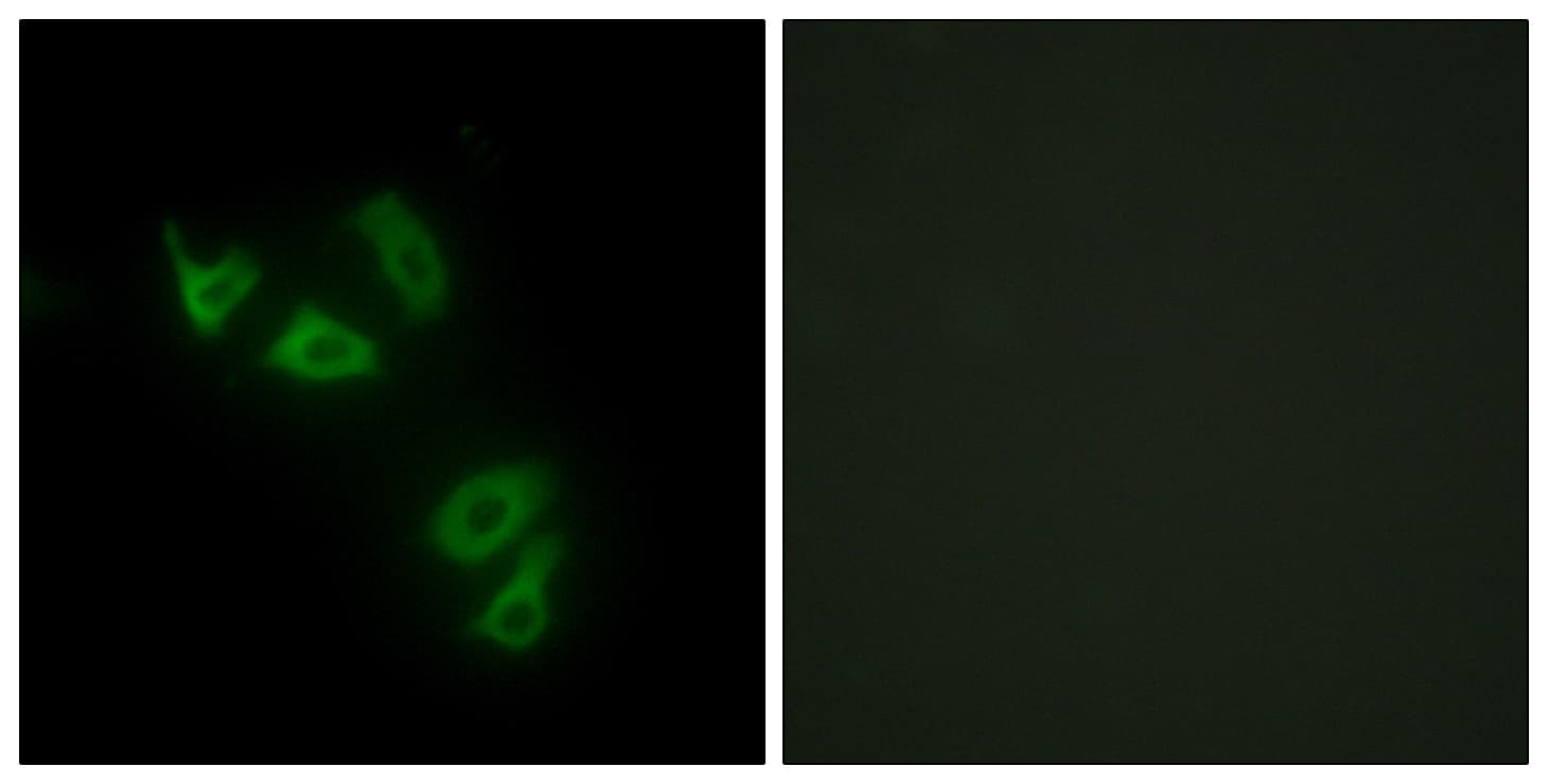 IHC-plus™ Polyclonal Rabbit anti-Human MUC13 Antibody (aa421-470, IHC, IF, WB)