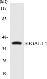 GALT4 / B3GALT4 Antibody (aa167-216)