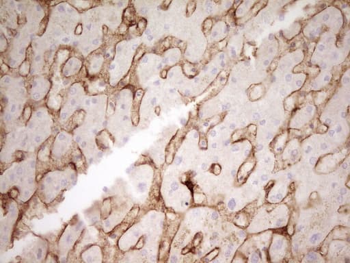 PROCR / EPCR Antibody (aa1-210, clone UMAB200)