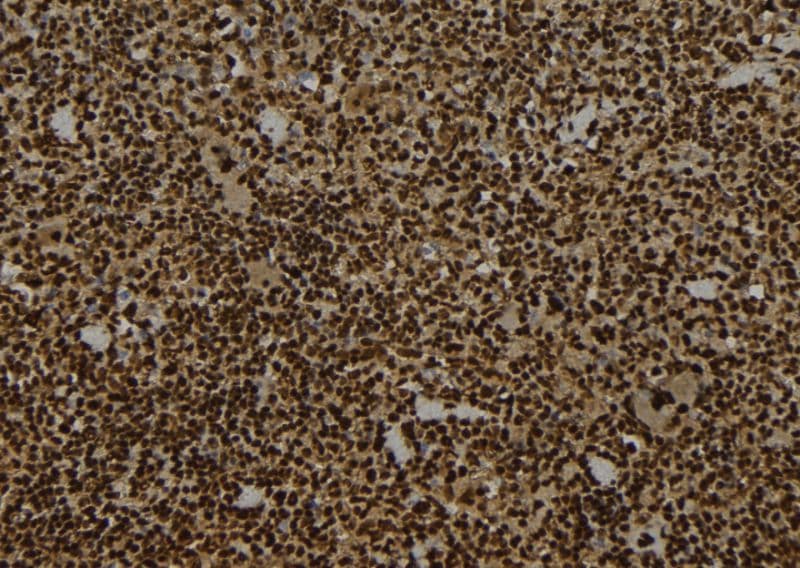 TCAB1 / WDR79 Antibody