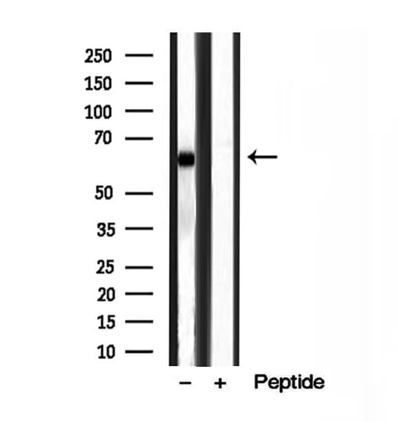 Polyclonal Rabbit anti-Human MKS1 Antibody (IHC, WB)
