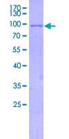 Human ALAS2 Protein (Recombinant GST)