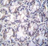 Polyclonal Rabbit anti-Human TBCA Antibody (aa30-58, IHC, WB)