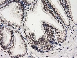 PRKCE / PKC-Epsilon Antibody (clone OTI2A12)