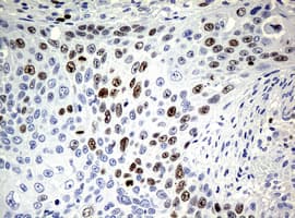 Monoclonal Mouse anti-Human MKI67 / Ki67 Antibody (clone OTI5D7, IHC)