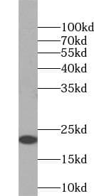 Asprosin Antibody