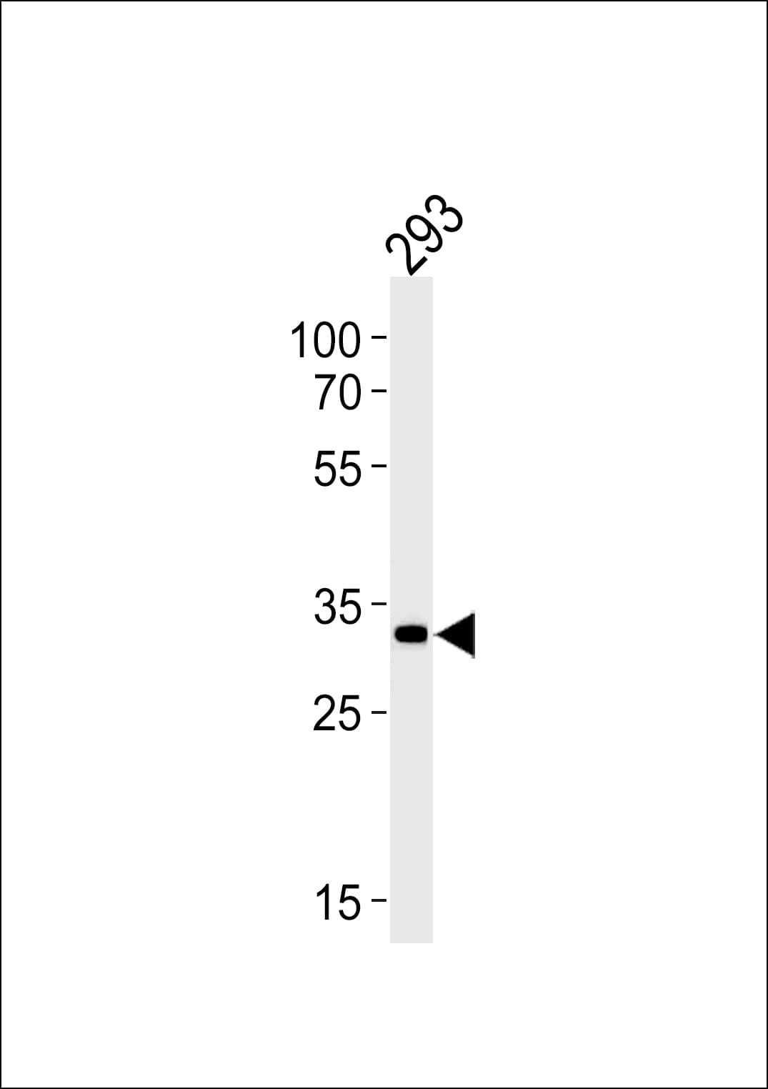 STUB1 / CHIP Antibody (aa236-263)