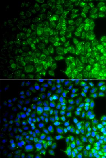 Polyclonal Rabbit anti-Human USP10 Antibody (IHC, IF, WB)