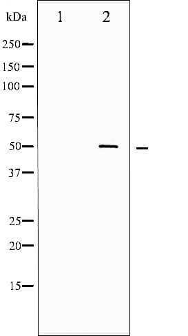 SRF / Serum Response Factor Antibody (phospho-Ser99)