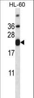 CD3E Antibody (aa154-182)