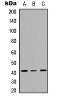 MAPK13 / p38delta Antibody (Internal)