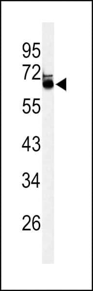 LRRTM1 Antibody (aa88-117)
