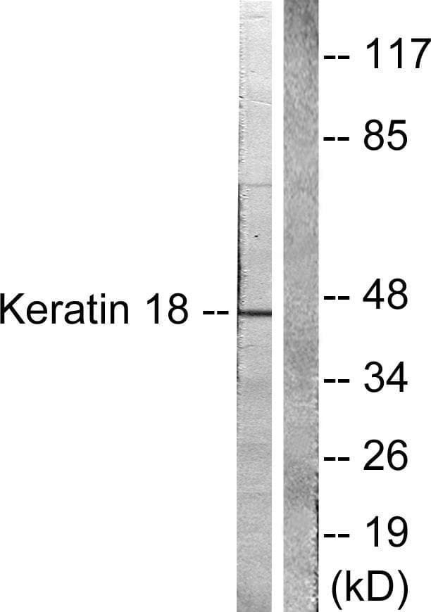KRT18 / CK18 / Cytokeratin 18 Antibody (p33)