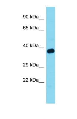 TOM1L1 Antibody (aa42-91)