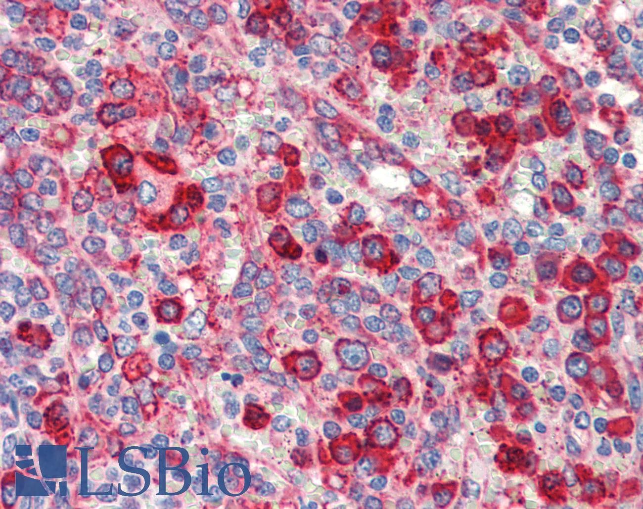 IHC-plus™ HSP90B1 / GP96 / GRP94 Antibody (clone 9G10)
