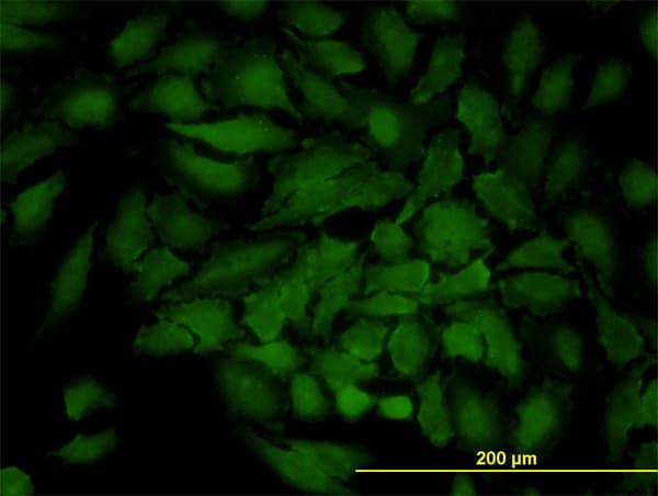 Monoclonal Mouse anti-Human GJB3 / CX31 / Connexin 31 Antibody (clone 3B4-1B3, IF, WB)