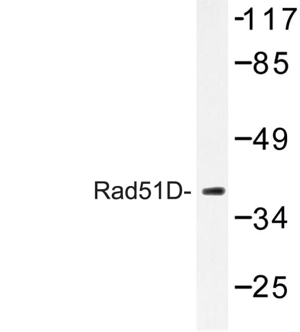 RAD51L3 / RAD51D Antibody (Ala152)
