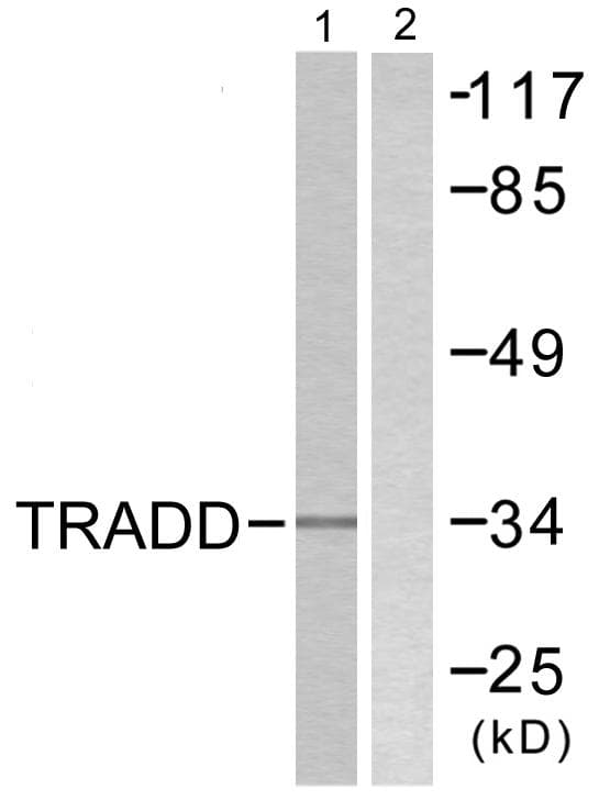 TRADD Antibody