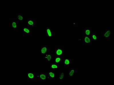 Polyclonal Rabbit anti-Human HIST1H4I Antibody (IHC, IF)