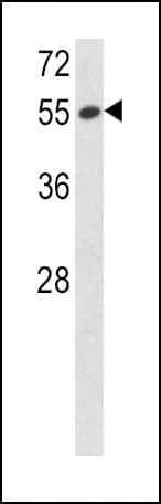 SERPINF1 / PEDF Antibody (aa9-36)