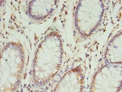 Polyclonal Rabbit anti-Human NSUN4 Antibody (IHC, WB)