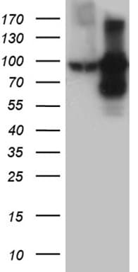 CD71 / Transferrin Receptor Antibody (clone OTI6H9)