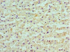 SULT2A1 / Sulfotransferase 2A1 Antibody (aa1-145)