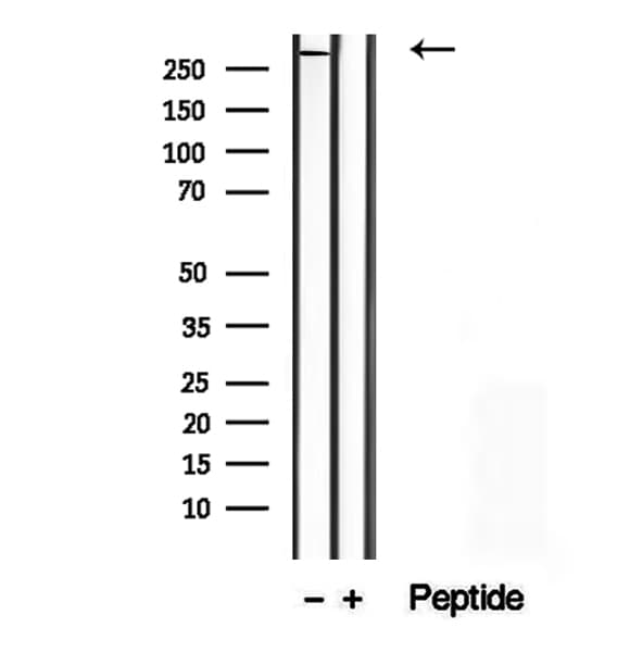 KIAA1840 / SPG11 Antibody
