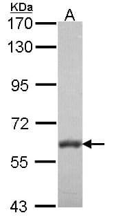 Polyclonal Rabbit anti-Human PALS2 / MPP6 Antibody (aa1-44, IHC, WB)