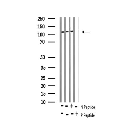 EGFR Antibody (phospho-Ser695)