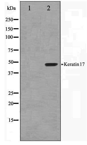 Polyclonal Rabbit anti-Human KRT17 / CK17 / Cytokeratin 17 Antibody (IHC, IF, WB)