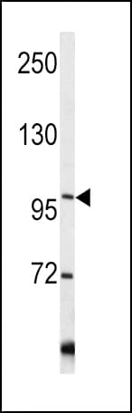 Polyclonal Rabbit anti-Human COL6A1 / Collagen VI Alpha 1 Antibody (aa831-858, IHC, IF, WB)