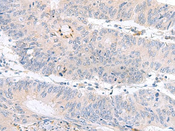 Polyclonal Rabbit anti-Human PDE6D / PDE6 Delta Antibody (IHC)