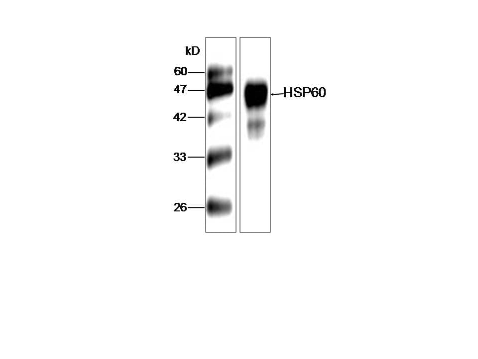 Legionella pneumophila groL Antibody (aa72-478, clone 59533-21)