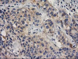 BCAR1 / p130Cas Antibody (clone OTI3A5)