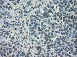 NEK6 Antibody (clone OTI2H7)