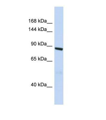 Polyclonal Rabbit anti-Human ARHGAP45 Antibody (aa147-196, WB)