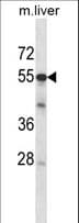 ADCK2 Antibody (aa232-259)