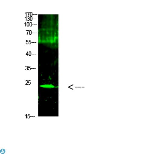 CTF1 / Cardiotrophin-1 Antibody